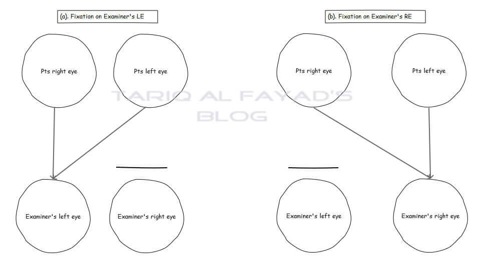 [[a]  Mesure de la PD proche. [a & b] Mesure de distance PD]