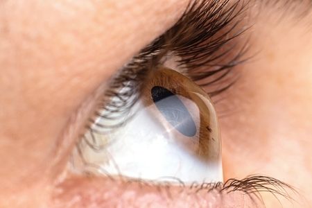 Quelles conditions de santé m'empêcheront de recevoir le LASIK ?