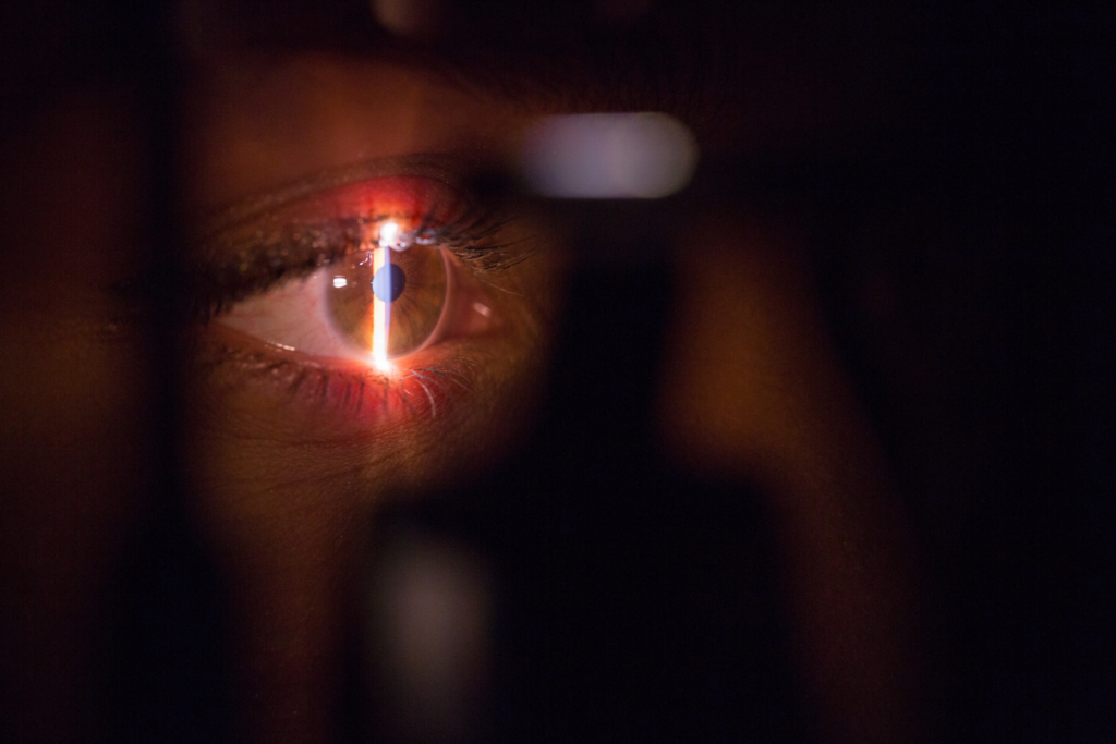 ruban de lumière brillant sur un œil ouvert lors d'un examen de la vue par un ophtalmologiste